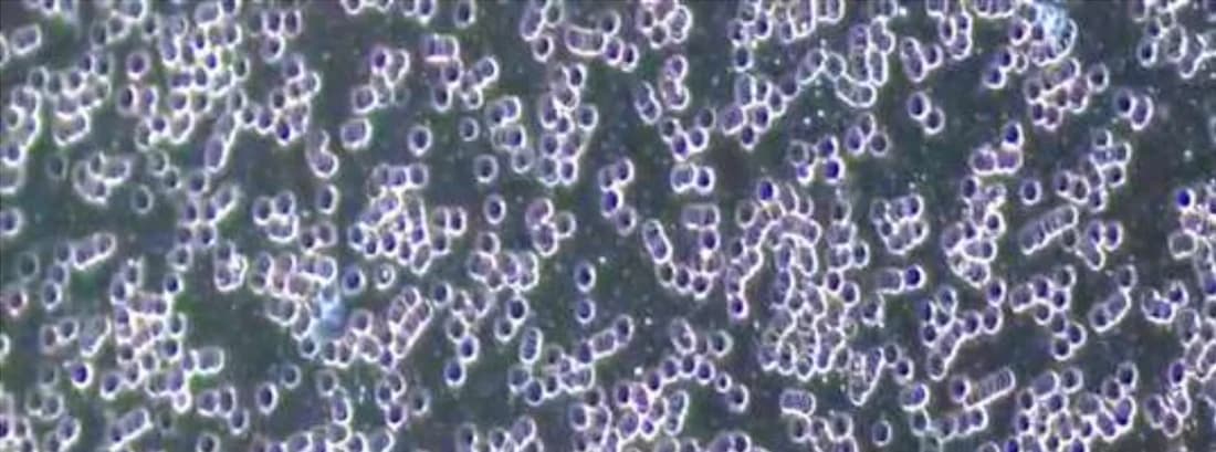 Darkfield microscopy after the session: cells separated and evenly dispersed