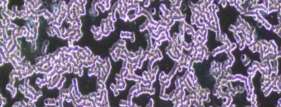 Darkfield microscopy before the session: red cells stacked edge-to-edge in long chains